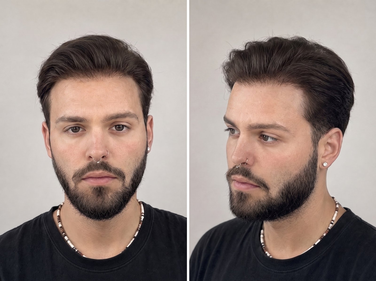 System nach AvexisHAIR-Spezifikation
